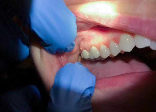 Best Pediatric Emergency Dentist in Medina, MN